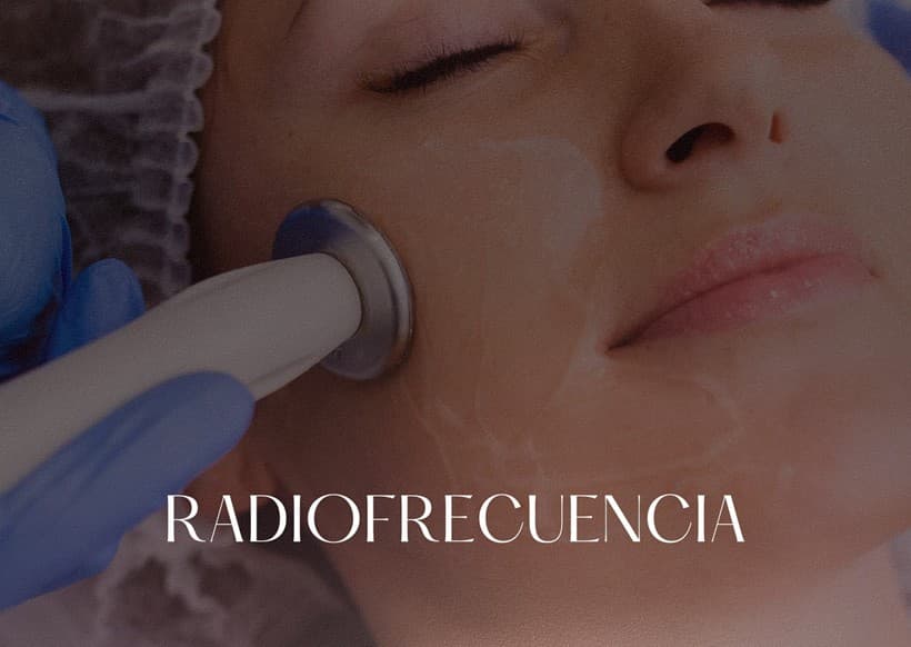 Radiofrecuencia